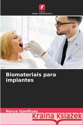 Biomateriais para implantes Navya Upadhyay 9786207582143 Edicoes Nosso Conhecimento - książka