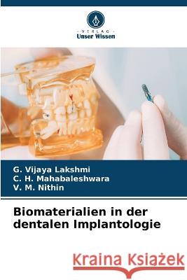 Biomaterialien in der dentalen Implantologie G. Vijay C. H. Mahabaleshwara V. M. Nithin 9786205748169 Verlag Unser Wissen - książka