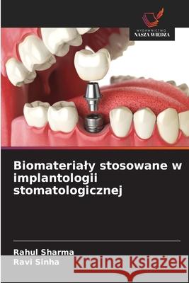 Biomaterialy stosowane w implantologii stomatologicznej sharma, Rahul, Sinha, Ravi 9786208963002 Wydawnictwo Nasza Wiedza - książka