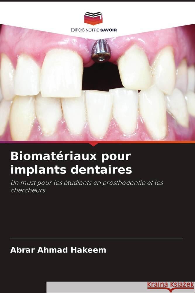 Biomat?riaux pour implants dentaires Abrar Ahmad Hakeem 9786207313877 Editions Notre Savoir - książka