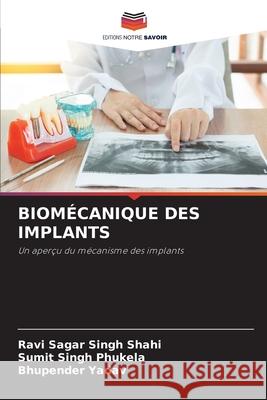 Biomécanique Des Implants Ravi Sagar Singh Shahi, Sumit Singh Phukela, Bhupender Yadav 9786204152721 Editions Notre Savoir - książka