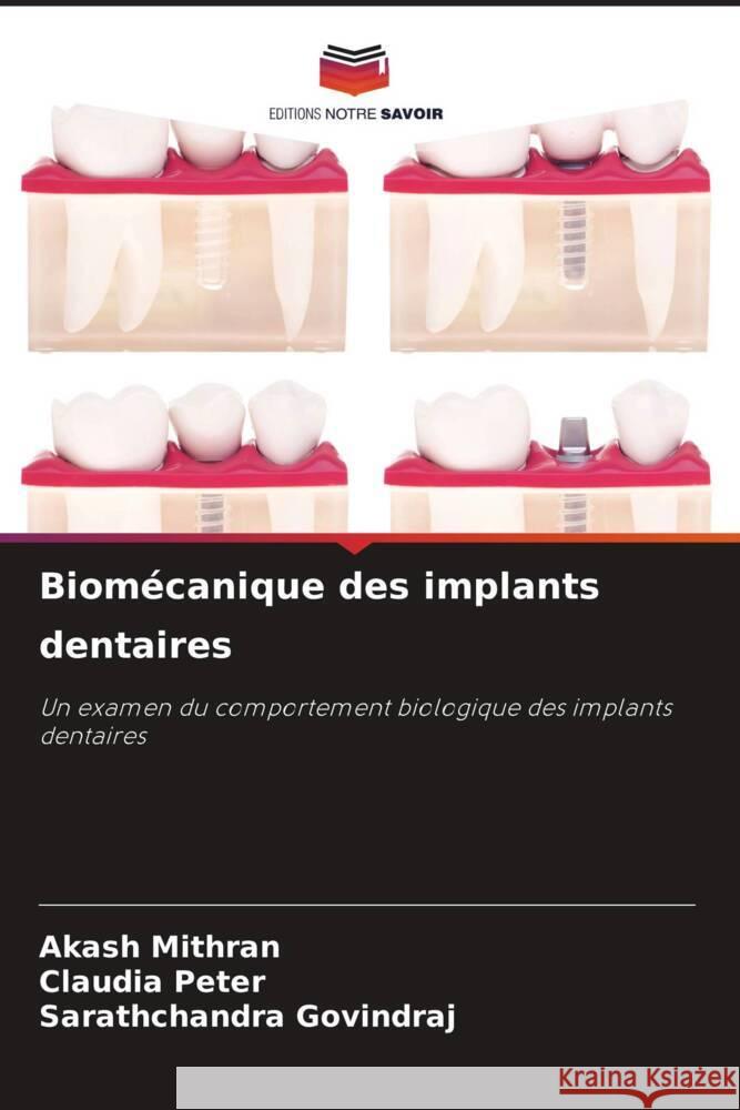 Biomécanique des implants dentaires Mithran, Akash, Peter, Claudia, GOVINDRAJ, Sarathchandra 9786206943822 Editions Notre Savoir - książka