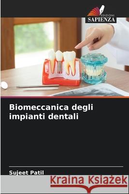 Biomeccanica degli impianti dentali Patil, Sujeet 9786202367370 Edizioni Sapienza - książka