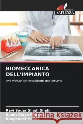 Biomeccanica Dell'impianto Ravi Sagar Singh Shahi, Sumit Singh Phukela, Bhupender Yadav 9786204152738 Edizioni Sapienza - książka