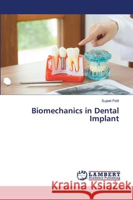 Biomechanics in Dental Implant Patil, Sujeet 9786208446444 LAP Lambert Academic Publishing - książka