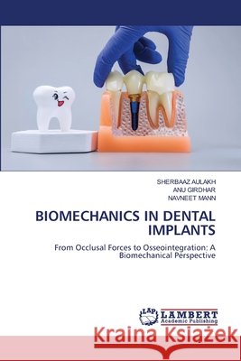 Biomechanics in Dental Implants Sherbaaz Aulakh Anu Girdhar Navneet Mann 9786630439496 LAP Lambert Academic Publishing - książka