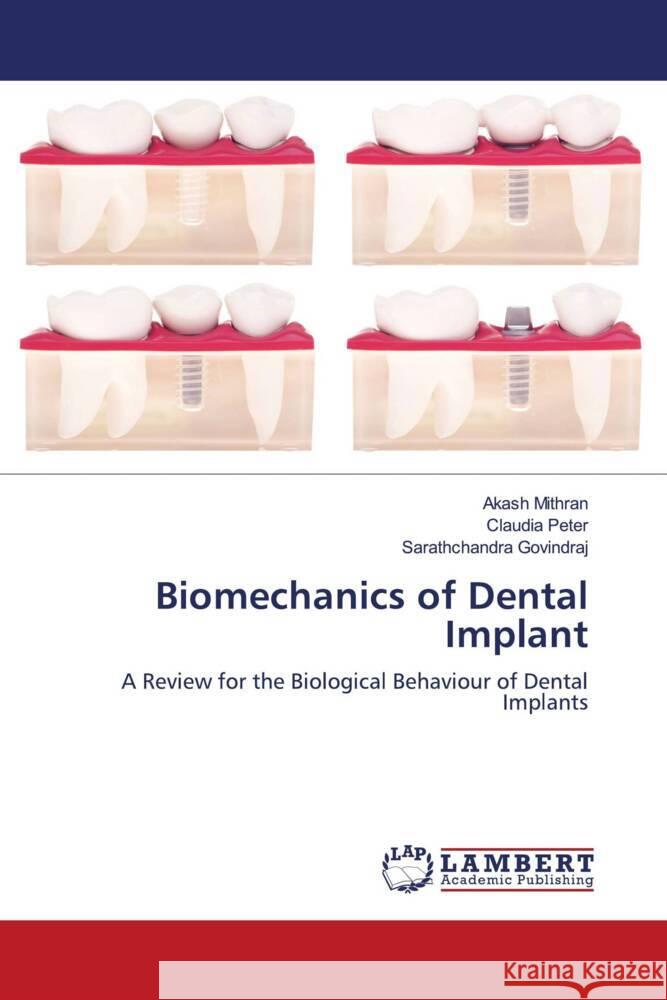 Biomechanics of Dental Implant Mithran, Akash, Peter, Claudia, GOVINDRAJ, Sarathchandra 9786207446957 LAP Lambert Academic Publishing - książka