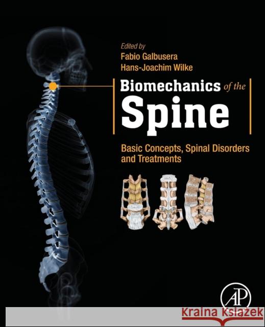 Biomechanics of the Spine: Basic Concepts, Spinal Disorders and Treatments Galbusera, Fabio 9780128128510 Academic Press - książka