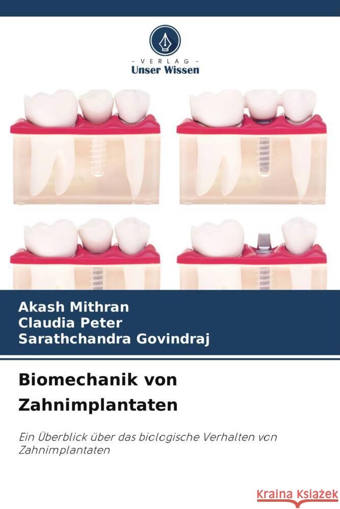 Biomechanik von Zahnimplantaten Mithran, Akash, Peter, Claudia, GOVINDRAJ, Sarathchandra 9786206943808 Verlag Unser Wissen - książka