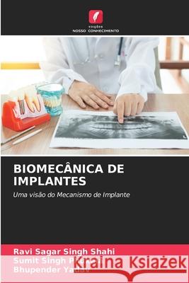 Biomecânica de Implantes Ravi Sagar Singh Shahi, Sumit Singh Phukela, Bhupender Yadav 9786204152745 Edicoes Nosso Conhecimento - książka