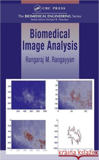 Biomedical Image Analysis Rangaraj M. Rangayyan 9780849396953 CRC Press - książka