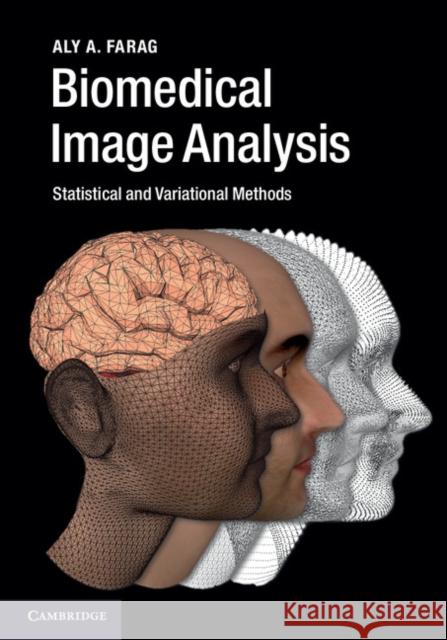 Biomedical Image Analysis: Statistical and Variational Methods Farag, Aly A. 9780521196796 CAMBRIDGE UNIVERSITY PRESS - książka
