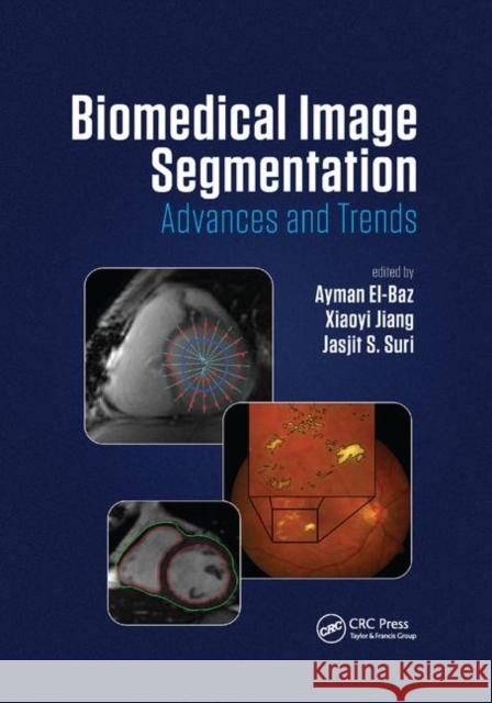 Biomedical Image Segmentation: Advances and Trends Ayman El-Baz Xiaoyi Jiang Jasjit S. Suri 9780367870867 CRC Press - książka