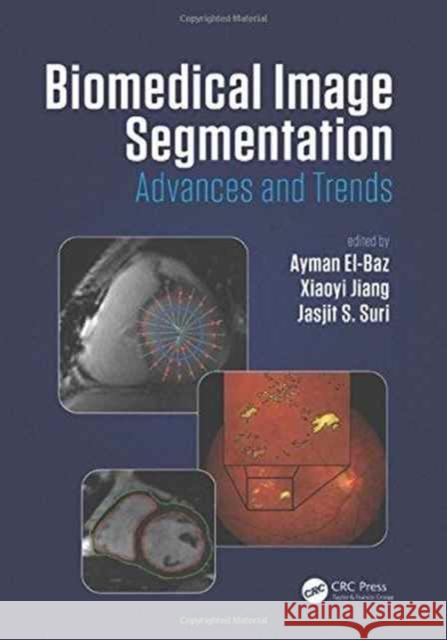 Biomedical Image Segmentation: Advances and Trends Ayman El-Baz Xiaoyi Jiang Jasjit S., Ed. Suri 9781482258554 CRC Press - książka