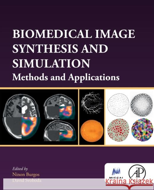 Biomedical Image Synthesis and Simulation: Methods and Applications Burgos, Ninon 9780128243497 Academic Press - książka
