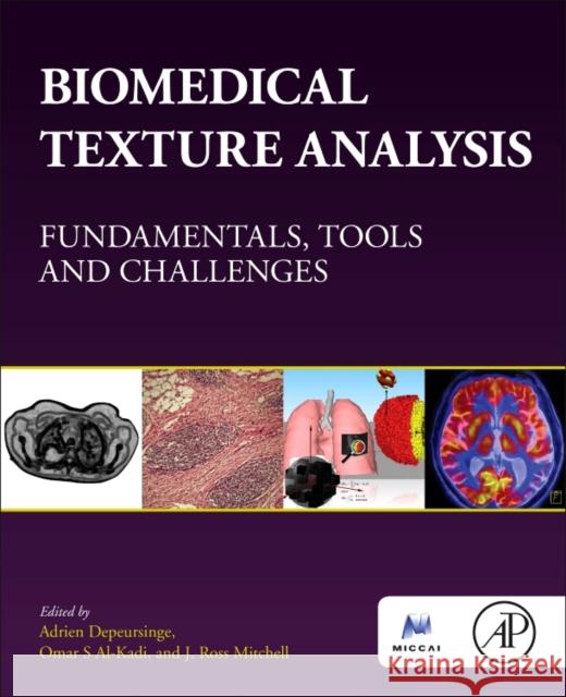 Biomedical Texture Analysis: Fundamentals, Tools and Challenges Adrien Depeursinge Omar S J. Ross Mitchell 9780128121337 Academic Press - książka