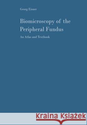 Biomicroscopy of the Peripheral Fundus: An Atlas and Textbook Eisner, Georg 9783642858055 Springer - książka