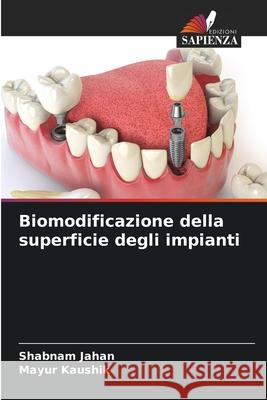 Biomodificazione della superficie degli impianti Jahan, Shabnam, Kaushik, Mayur 9786206869849 Edizioni Sapienza - książka