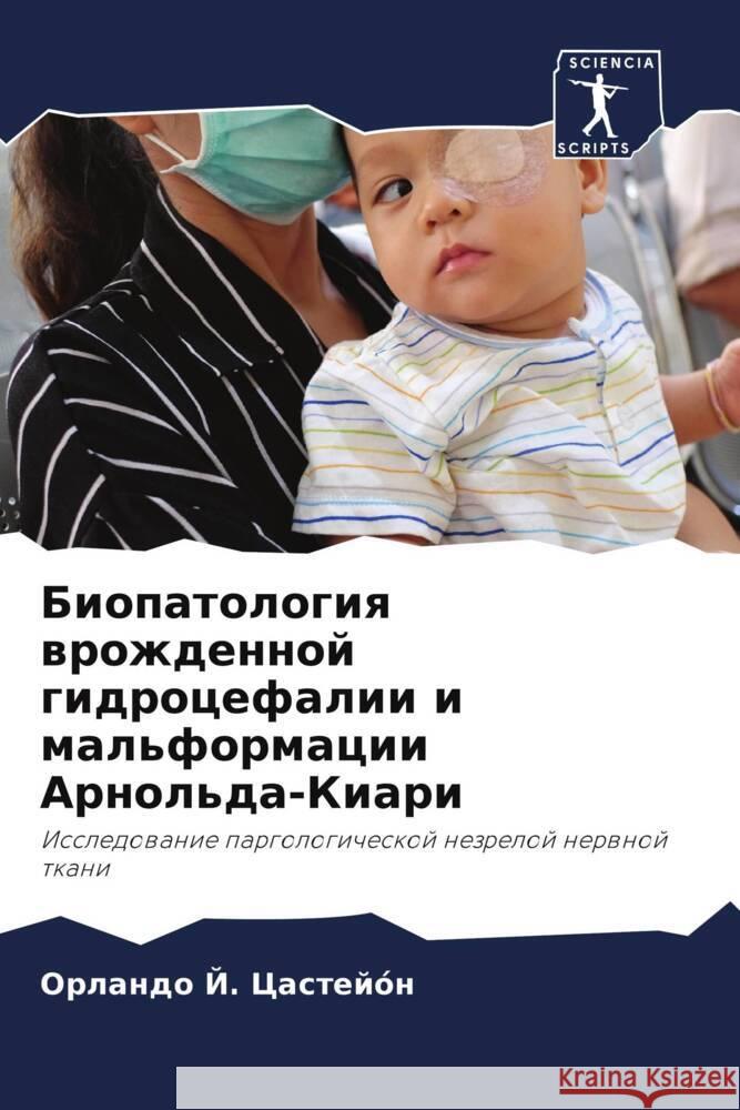 Biopatologiq wrozhdennoj gidrocefalii i mal'formacii Arnol'da-Kiari Castejón, Orlando J. 9786204402970 Sciencia Scripts - książka