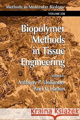 Biopolymer Methods in Tissue Engineering Anthony P. Hollander Paul V. Hatton Anthony P. Hollander 9780896039674 Humana Press - książka