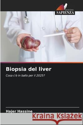 Biopsia del liver Hassine, Hajer 9786209427848 Edizioni Sapienza - książka
