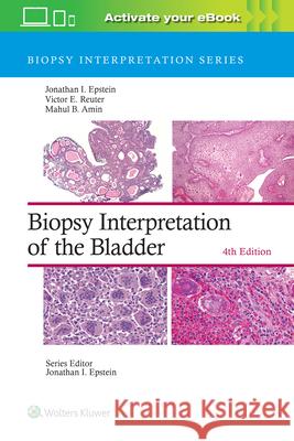 Biopsy Interpretation of the Bladder Jonathan I. Epstein Victor E. Reuter Mahul B. Amin 9781975199203 LWW - książka