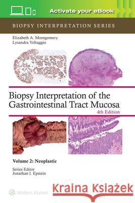 Biopsy Interpretation of the Gastrointestinal Tract Mucosa Volume 2: Neoplastic: Print + eBook with Multimedia LYSANDRA VOLTAGGIO 9781975213695 LWW - książka