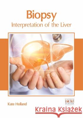 Biopsy: Interpretation of the Liver Kate Holland 9781632426789 Foster Academics - książka