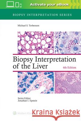 Biopsy Interpretation of the Liver Michael Torbenson 9781975157296 Wolters Kluwer Health - książka