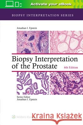 Biopsy Interpretation of the Prostate Jonathan I. Epstein Andres Matoso 9781975136543 Wolters Kluwer Health - książka
