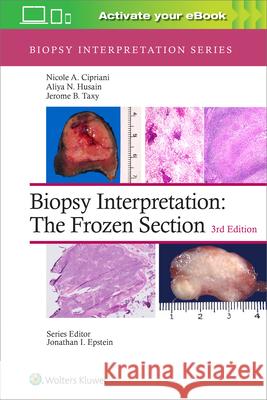 Biopsy Interpretation: The Frozen Section Nicole A. Cipriani Aliya N. Husain Jerome B. Taxy 9781975170073 Wolters Kluwer Health - książka