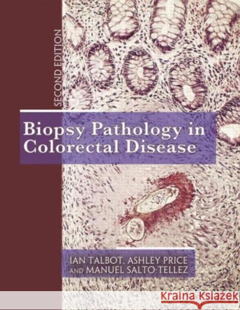 Biopsy Pathology in Colorectal Disease, 2ed Talbot, Ian 9780340759226  - książka