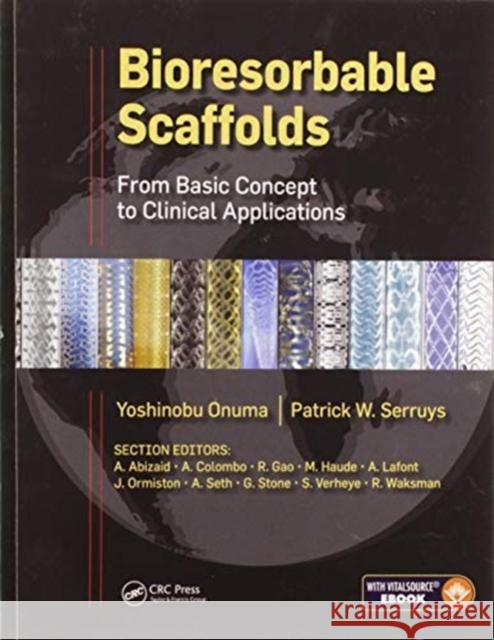 Bioresorbable Scaffolds: From Basic Concept to Clinical Applications Yoshinobu Onuma Patrick W. J. C. Serruys 9780367572839 CRC Press - książka