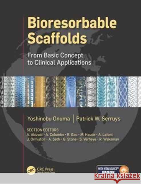 Bioresorbable Scaffolds: From Basic Concept to Clinical Applications Patrick Serruys Yoshinobu Onuma 9781498779746 CRC Press - książka