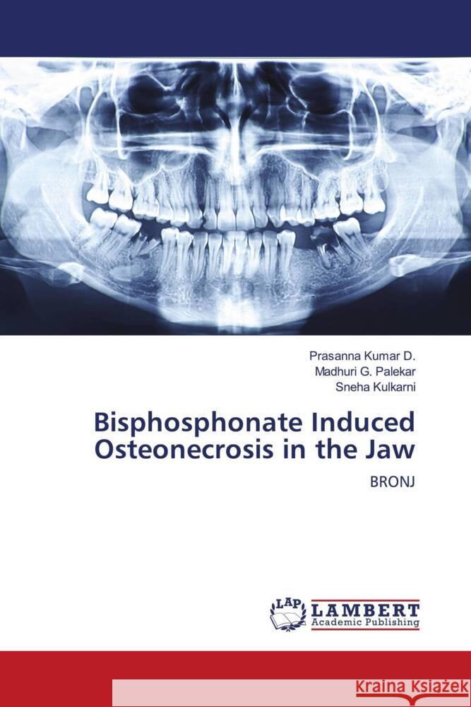 Bisphosphonate Induced Osteonecrosis in the Jaw Kumar D., Prasanna, G. Palekar, Madhuri, Kulkarni, Sneha 9786203024401 LAP Lambert Academic Publishing - książka