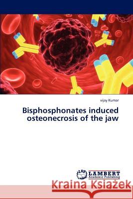 Bisphosphonates induced osteonecrosis of the jaw Kumar Vijay 9783659322136 LAP Lambert Academic Publishing - książka