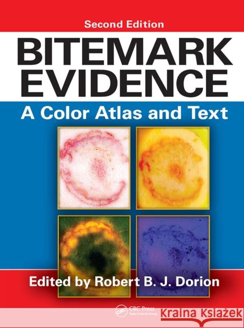 Bitemark Evidence: A Color Atlas and Text, 2nd Edition Robert B. J. Dorion 9781032917863 CRC Press - książka