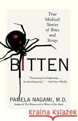Bitten: True Medical Stories of Bites and Stings Pamela Nagami 9780312318239 St. Martin's Griffin - książka
