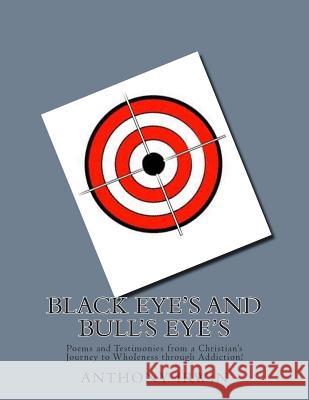 Black Eye's and Bull's Eye's MR Anthony J. Irwin 9781494363451 Createspace - książka
