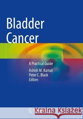 Bladder Cancer: A Practical Guide Kamat, Ashish M. 9783030706487 Springer International Publishing - książka