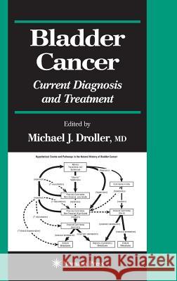 Bladder Cancer: Current Diagnosis and Treatment Michael J. Droller 9780896038189 Humana Press - książka