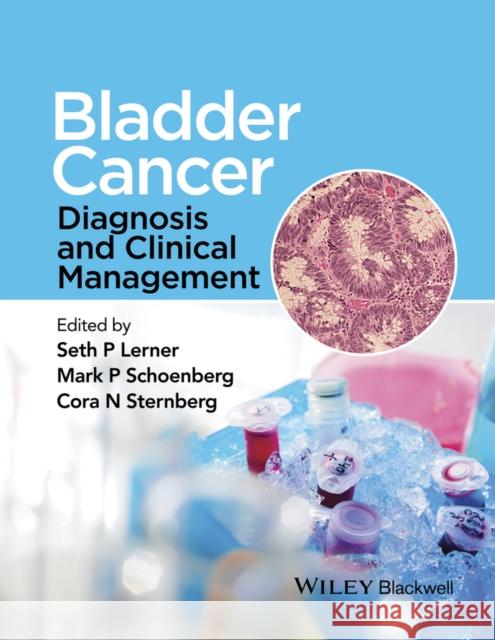 Bladder Cancer: Diagnosis and Clinical Management Lerner, Seth P. 9781118674840 Wiley-Blackwell - książka