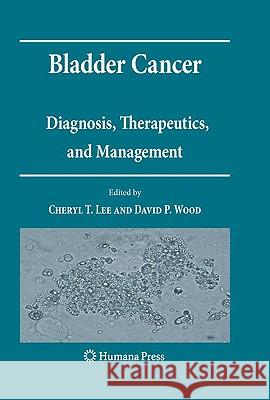 Bladder Cancer: Diagnosis, Therapeutics, and Management Lee, Cheryl T. 9781588299888 HUMANA PRESS INC.,U.S. - książka