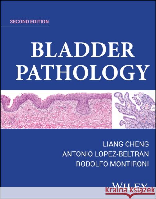 Bladder Pathology Rodolfo Montironi 9781119707554 Wiley - książka