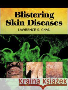 Blistering Skin Diseases Lawrence Chan 9781840760668 MANSON PUBLISHING LTD - książka