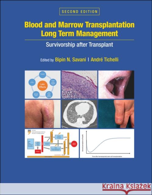 Blood and Marrow Transplantation Long Term Management: Survivorship After Transplant Savani, Bipin N. 9781119612698 Wiley-Blackwell - książka