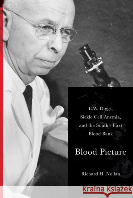Blood Picture: L. W. Diggs, Sickle Cell Anemia, and the South's First Blood Bank Richard Nollan 9781621902218 Univ Tennessee Press - książka