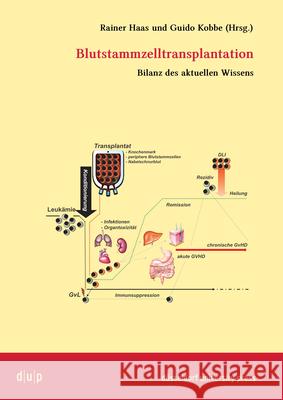 Blutstammzelltransplantation  9783940671998 Düsseldorf University Press - książka