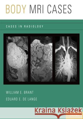 Body MRI Cases William E. Brant Eduard E. de Lange  9780199740710 Oxford University Press Inc - książka