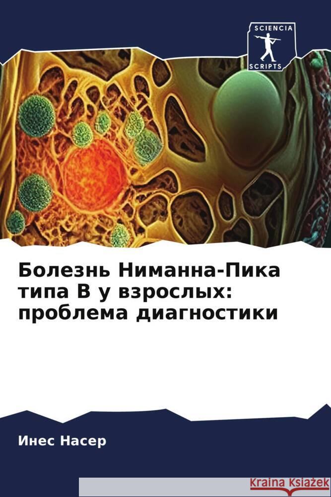 Bolezn' Nimanna-Pika tipa V u wzroslyh: problema diagnostiki Naser, Ines 9786208161132 Sciencia Scripts - książka